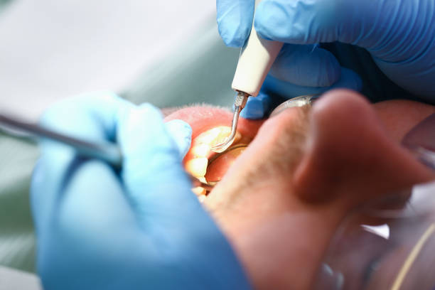 Best Pediatric Emergency Dentist in Falmouth, VA