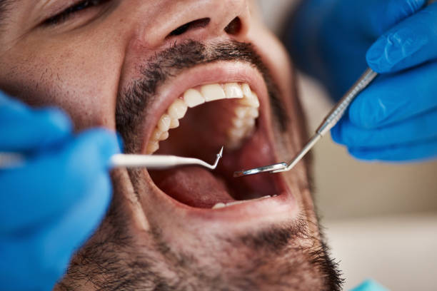 Best Emergency Dental Services for Seniors in Falmouth, VA