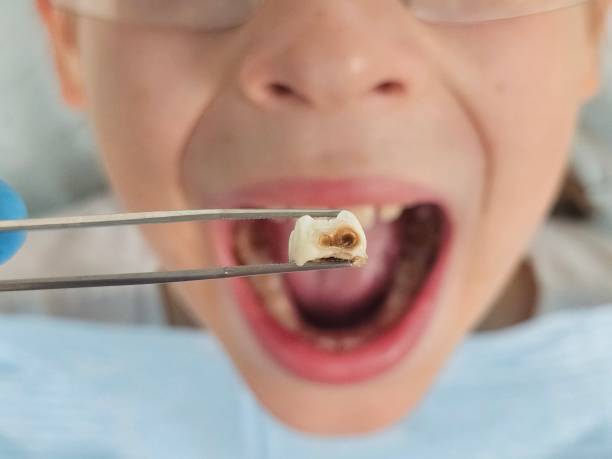 Best 24-Hour Emergency Dentist in Falmouth, VA